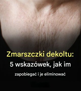 Zmarszczki na szyi: 5 wskazówek, jak im zapobiegać i jak je eliminować