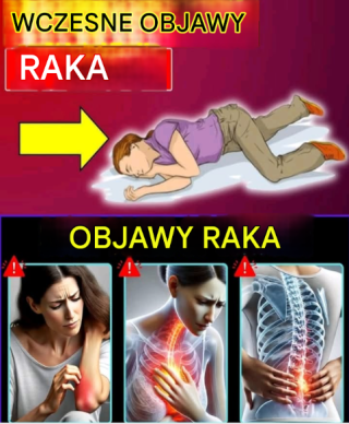 12 cichych objawów raka, które wiele osób ignoruje, nie zdając sobie sprawy z ryzyka
