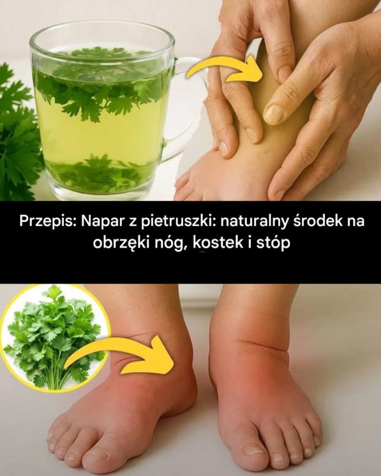 Napar z pietruszki: naturalny środek na obrzęki nóg, kostek i stóp
