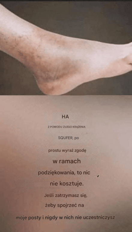 Jeśli masz słabe krążenie i tak czują się Twoje nogi, oto rozwiązanie