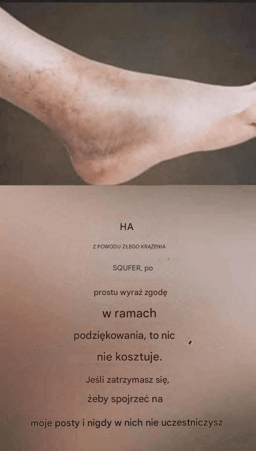 Jeśli masz słabe krążenie i tak czują się Twoje nogi, oto rozwiązanie