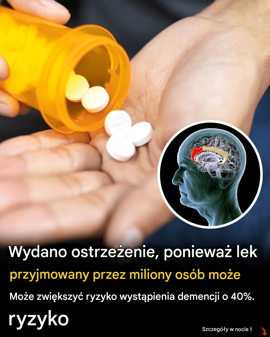 Obszerne badanie sugeruje, że popularny lek na ból pleców może wiązać się ze zwiększonym ryzykiem demencji.