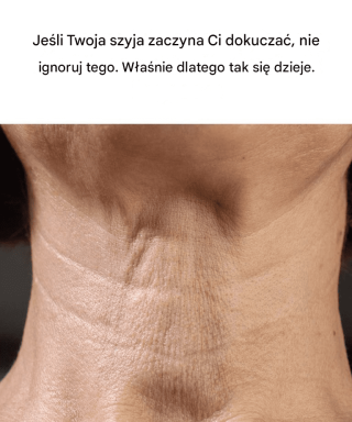 Jeśli Twoja szyja zaczyna opadać, nie ignoruj ​​tego. Oto przyczyna. Pełny artykuł